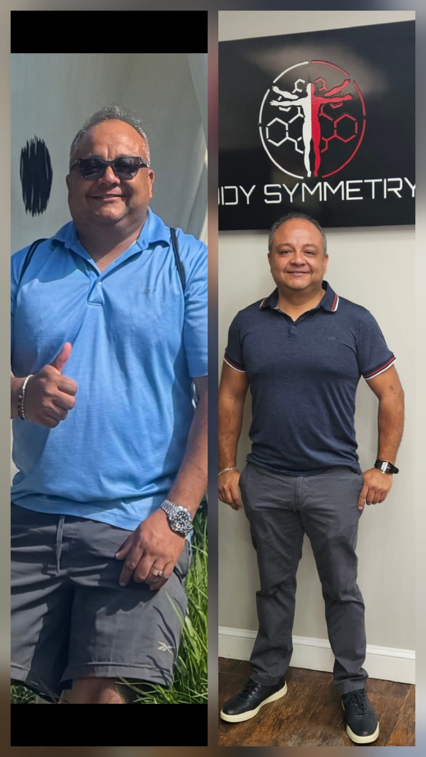 Emerson D. before and after at Body Symmetry MD