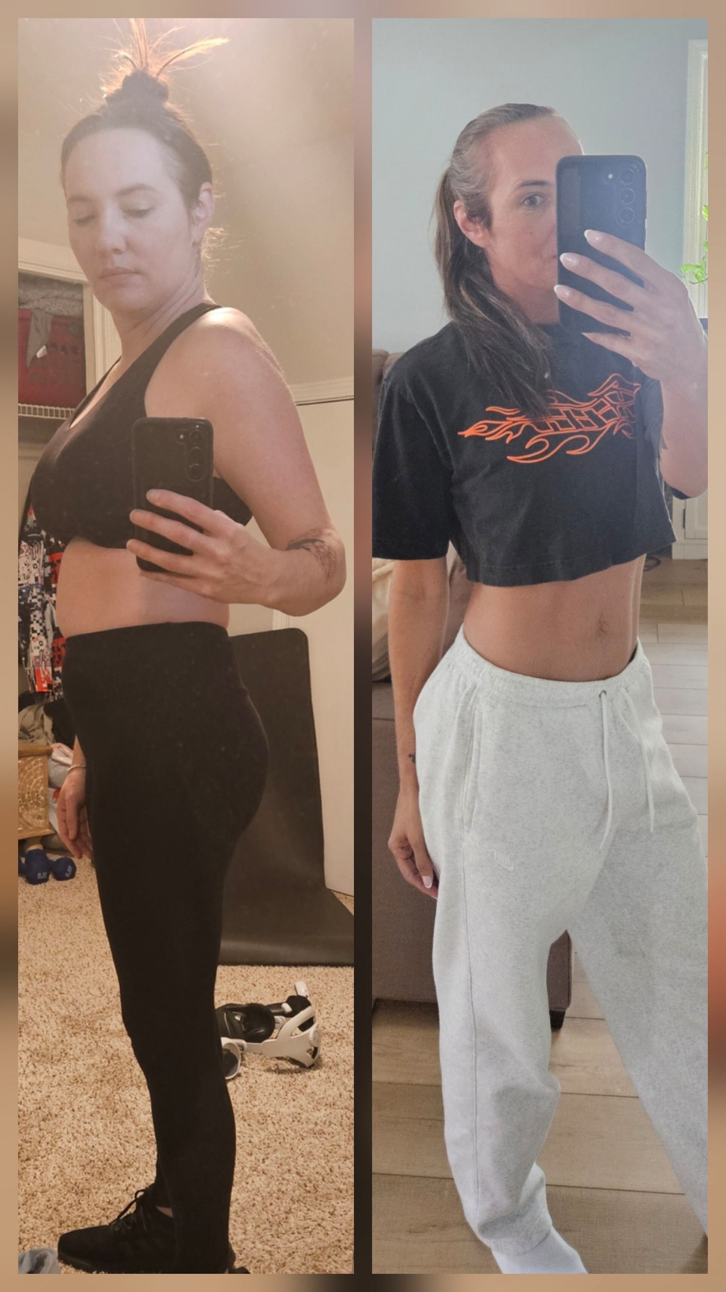 Patient before and after at Body Symmetry MD